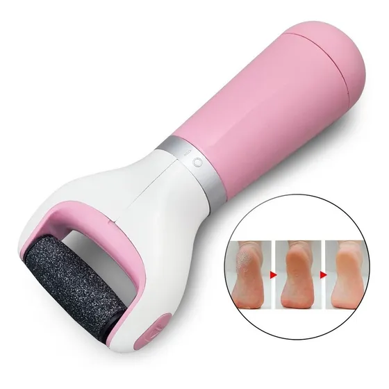 Removedor De Piel Seca Callos Tratamiento Exfoliante Para Pies Y Manos Con Durezas E Impurezas De Alta Calidad Everest