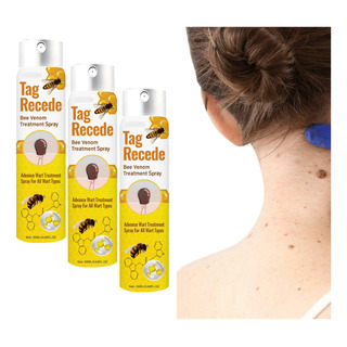 3 Unidades 20 Ml Verrugas Veneno Abeja Spray A 3 Unidades 20 Ml Verrugas Veneno Abeja Spray A