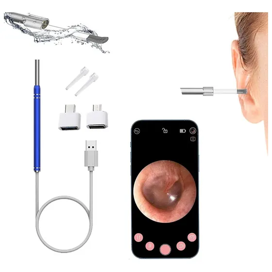 Cámara Otoscopio - Endoscopio Para Oido 3 En 1 Usb Tipo C