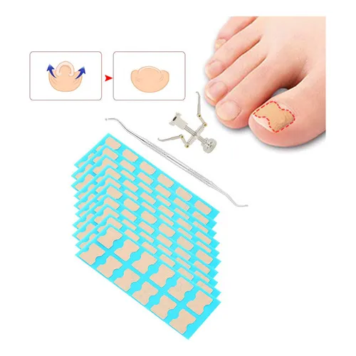 * Parche De Corrección De Uñas Encarnadas Corrector De Uñas