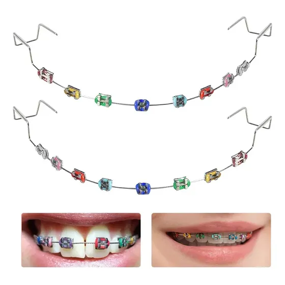 Aparatos Dentales Falsos Aparatos Dentales Falsos Protector