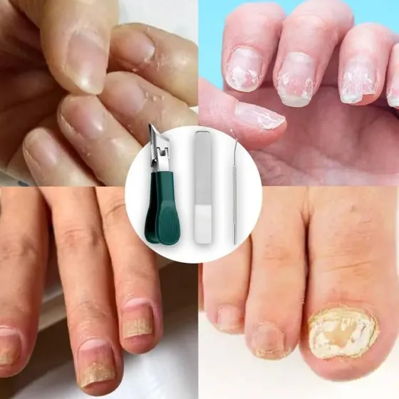 Cortador De Unhas Chanfrado Eagle Beak, Cortador De Unhas