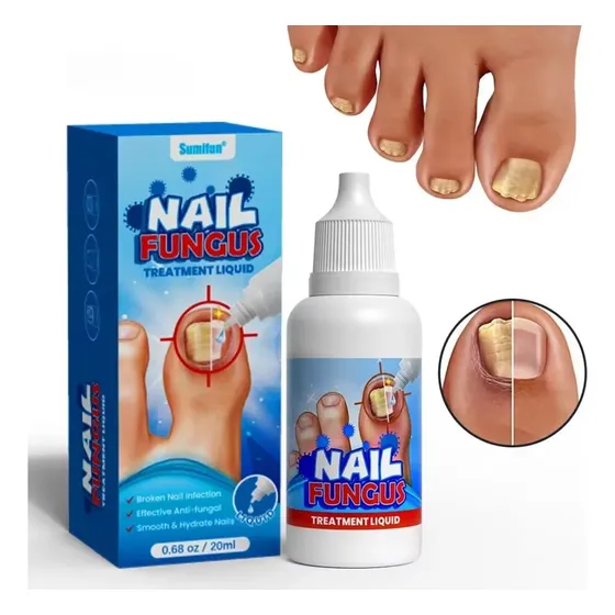 Crema Tratamiento Por Hongos Onicomicosis En Las Uñas 