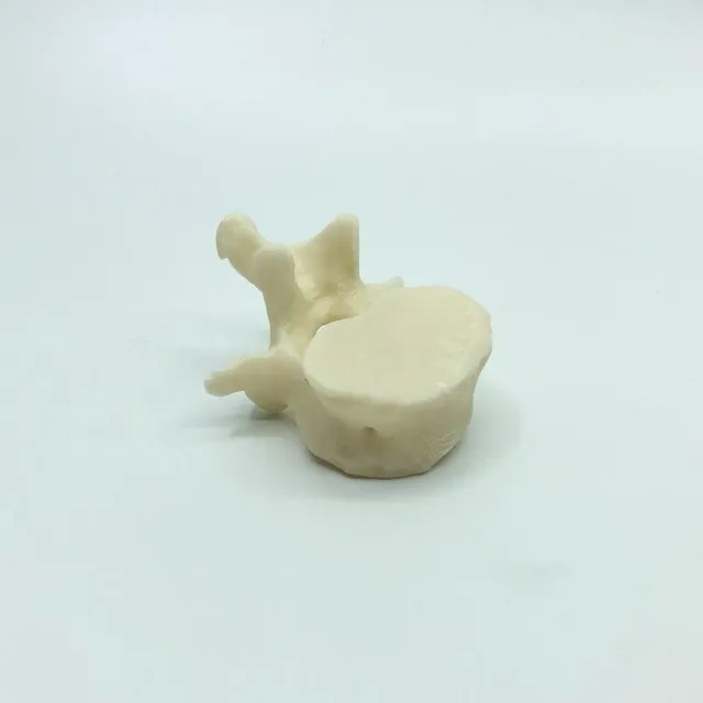 Vertebra Lumbar - Impresión 3d- Anatomía- Stock Disponible