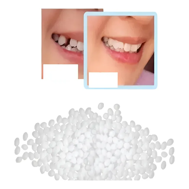 Massa Restauração Dente Provisório 150 Bolinhas Massa