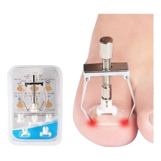 Kit Herramienta Pedicura De Corrección Para Uñas Encarnadas 