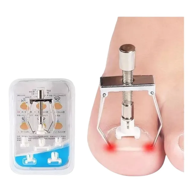 Kit Herramienta Pedicura De Corrección Para Uñas Encarnadas 