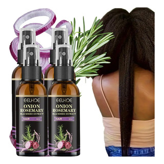 Aceite De Romero Y Cebolla Tratamientos Para El Cabello 4pcs Aceite De Romero Y Cebolla Tratamientos Para El Cabello 4pcs
