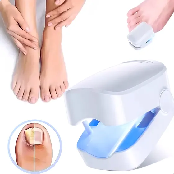 Dispositivo A Laser Tratamento De Fungos Micose Nas Unhas