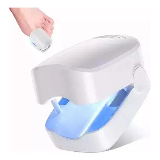 Laser Para Remover Fungos Nas Unhas. Onicomicose.
