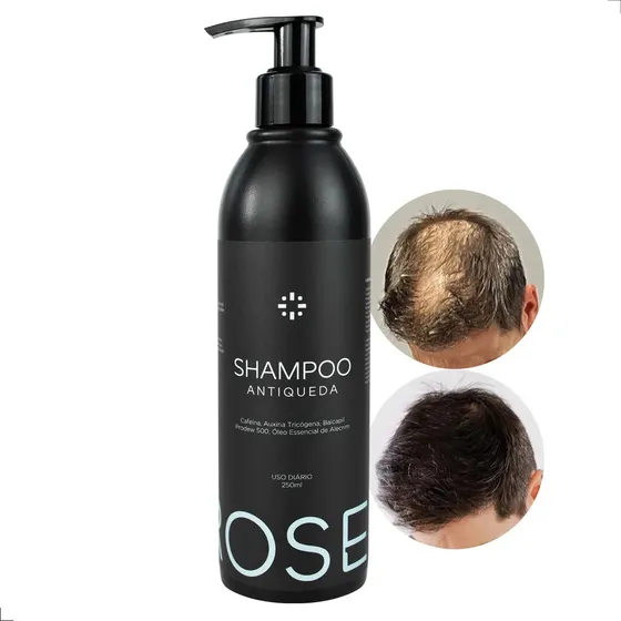 Shampoo Proself Para Calvície Masculina