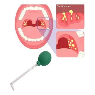 Herramienta De Extracción De Cálculos De Amígdalas Para Adul Herramienta De Extracción De Cálculos De Amígdalas Para Adul