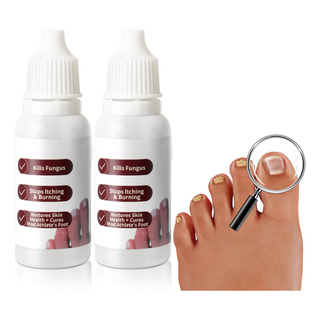 30ml Líquido Para Hongos En Las Uñas-mata Los Hongos En Las 30ml Líquido Para Hongos En Las Uñas-mata Los Hongos En Las