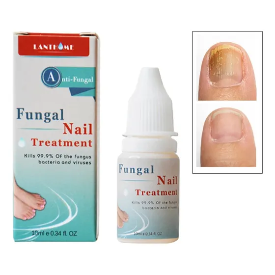 Suero  Para Hongos En Uñas - Pies Y Manos 2und