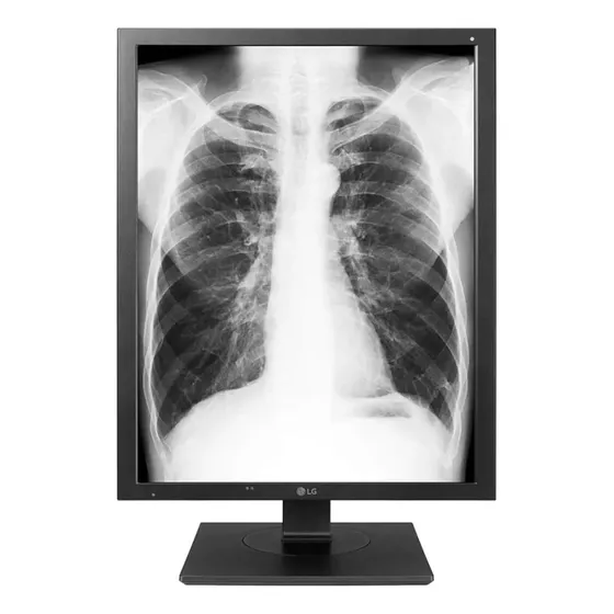 Monitor De Diagnóstico LG Multi Resolución Ajustable 