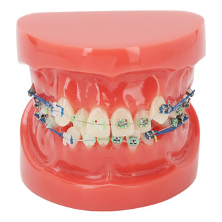 Modelo De Dientes De Aparatos De Ortodoncia Con Soportes, Modelo De Dientes De Aparatos De Ortodoncia Con Soportes,