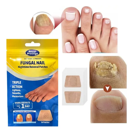 Parche Nocturno Para Tratamiento Hongos De Uñas Onicomicosis