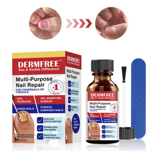 30ml LĂquido Para Hongos En Las Uñas-tratar Las Uñas Dañadas 30ml LĂquido Para Hongos En Las Uñas-tratar Las Uñas Dañadas