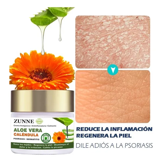 Crema Psoriasis Y Dermatitis / Aloe Vera Puro / Caléndula