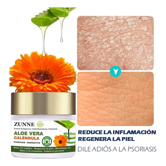 Crema Psoriasis Y Dermatitis / Aloe Vera Puro / Caléndula