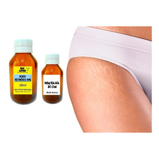 Ăcido RetinoĂco 40% + GlicĂłlico 40% Bio Lotus 10ml Cada Ăcido RetinoĂco 40% + GlicĂłlico 40% Bio Lotus 10ml Cada