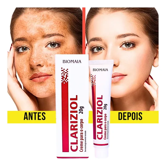 Melhor Creme Pra Melasma Coreano Remove Sarda Controla Acne