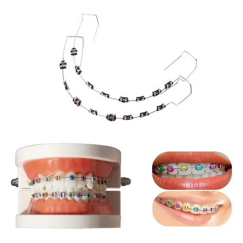Wire For Braces Kids Fake Braces Lip Protector Colorful Brac | MercadoLibre