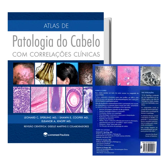 Livro Atlas De Patologia Do Cabelo Com Correlações Clínicas, + De 550 Imagens Coloridas / Passo A Passo Para Interpretação Histológica E Diagnóstica, Capa Dura, - Leonard Sperling