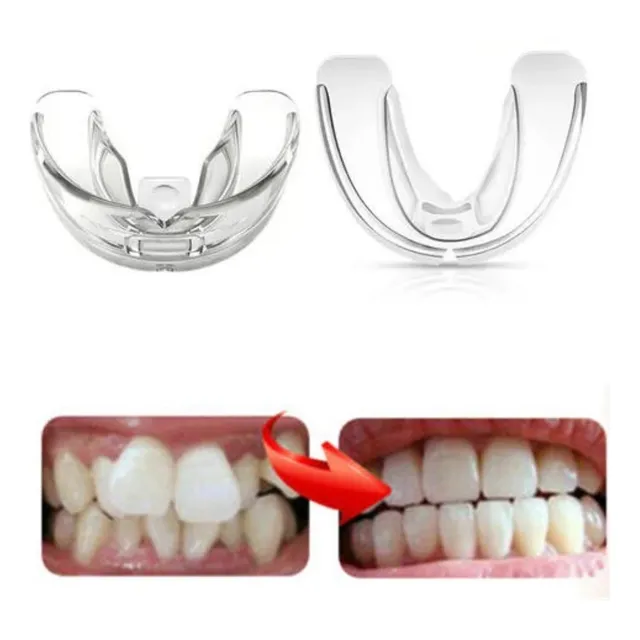 Aparelho Invisível Para Alinhar Dentes Móvel Hard + Brinde