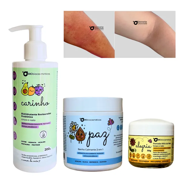 Kit Completo Alívio Da Pele [dermatite]