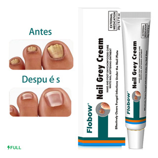 Tratamento Hongo De Uñas Elimina Eficazmente Los Hongo Tratamento Hongo De Uñas Elimina Eficazmente Los Hongo