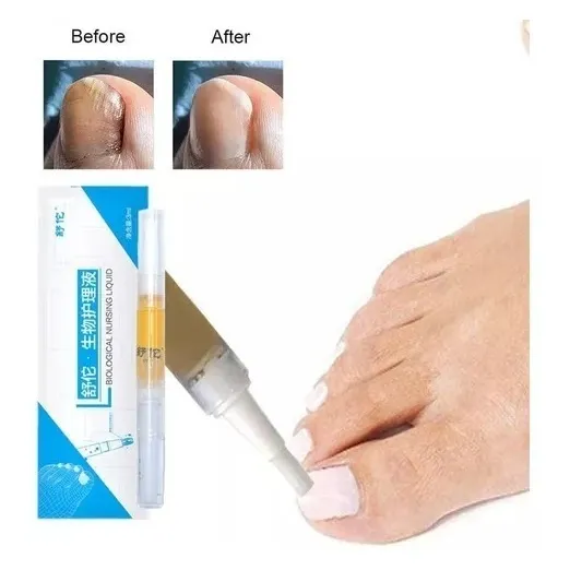 Crema Eliminadora De Hongos / Uñas / Pies Tienda Cod 3297