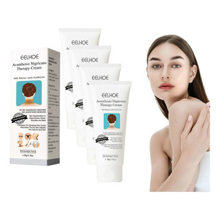 4×fixderma Nigrifix Crema Para Acantosis Nigricans Fbg E 4×fixderma Nigrifix Crema Para Acantosis Nigricans Fbg E