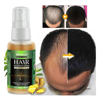Tratamento Da CalvĂcie Ibealee Cure O Cabelo Careca Freeship Tratamento Da CalvĂcie Ibealee Cure O Cabelo Careca Freeship