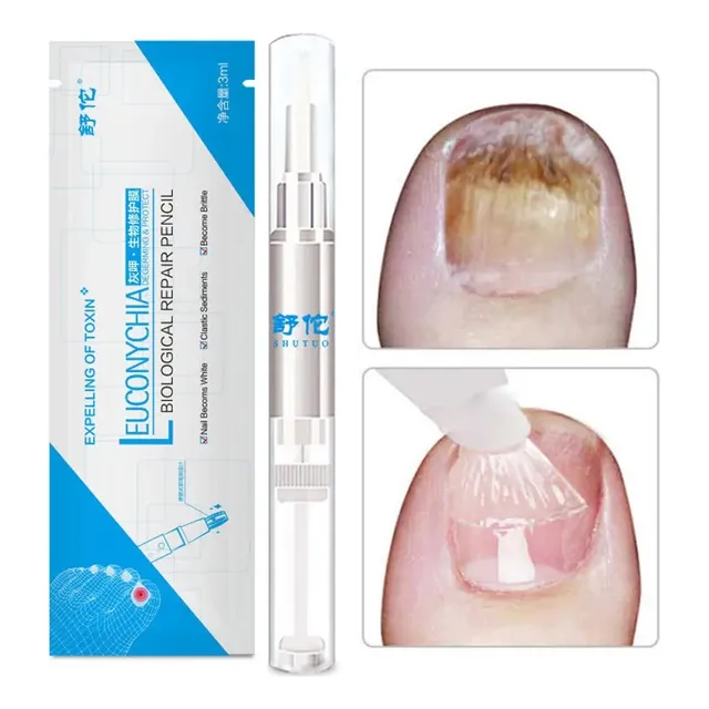 Crema Eliminadora De Hongos / Uñas / Pies 3ml M131