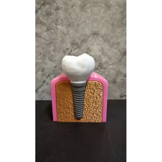Modelo Anatómico Corona Dental