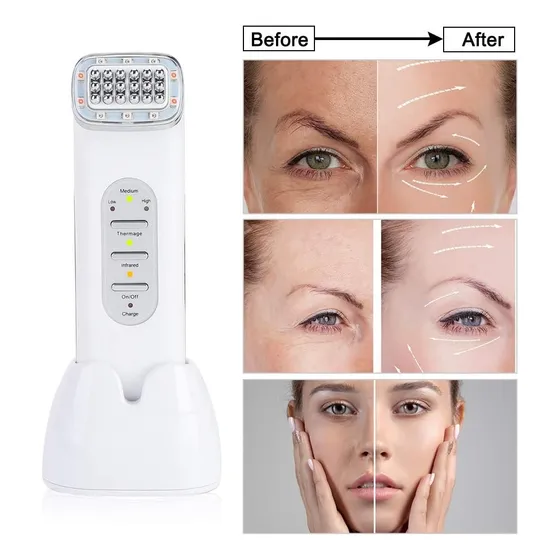 Radiofrecuencia Fraccionada Facial Sin Agujas Anti Edad/led