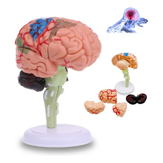 Modelo De Enseñanza De Ensamblaje Cerebral De Simulación Modelo De Enseñanza De Ensamblaje Cerebral De Simulación