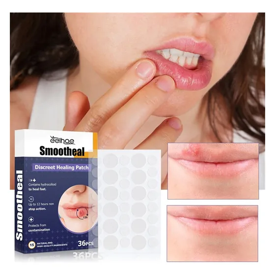 Parches Suavizantes Para Herpes Labial Parche Curativo Discr