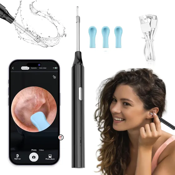 Limpia Oidos Extractor Cera Digital Camara Video Otoscopio