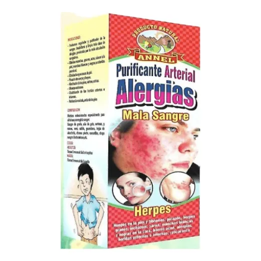 Pack X 3 Un Extracto Antialergico (purificante De La Sangre)