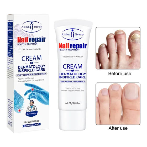 Crema Reparadora De Uñas Para Hongos Y Micosis
