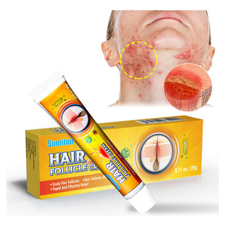Bálsamos, Crema Para La Dermatitis Seborreica, Crema Para El Bálsamos, Crema Para La Dermatitis Seborreica, Crema Para El