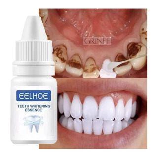 Clareador Branqueador Dental - Dentes Brancos E Sem Manchas! Clareador Branqueador Dental - Dentes Brancos E Sem Manchas!