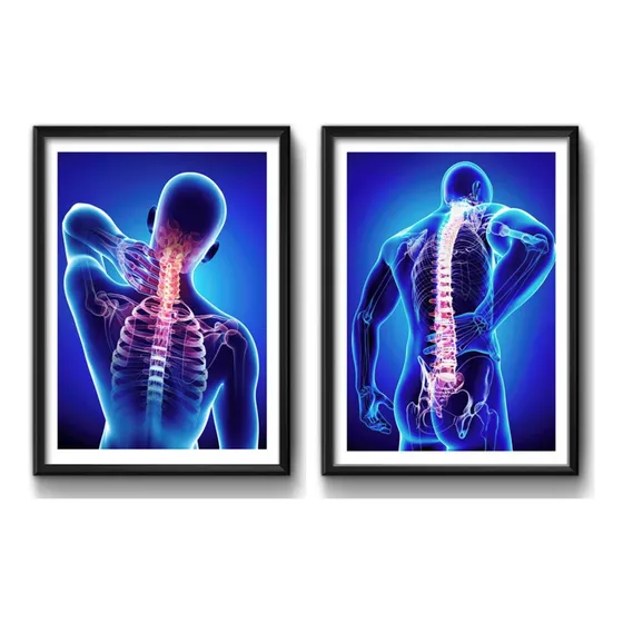 Set 2 Cuadros Ortopedia Médico Rayos X Cuerpo Humano Clinica
