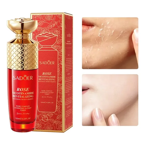 Tônico De Niacinamida Rosa 120ml Para Cuidados Com A Pele Hi