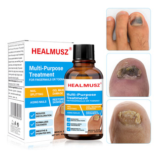 Healmusz Hongo En Uñas Solución-inhibición 99% Hongos 30ml Healmusz Hongo En Uñas Solución-inhibición 99% Hongos 30ml