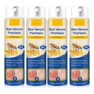 Spray For El Tratamiento De La Psoriasis De 20ml*4pcs Spray For El Tratamiento De La Psoriasis De 20ml*4pcs
