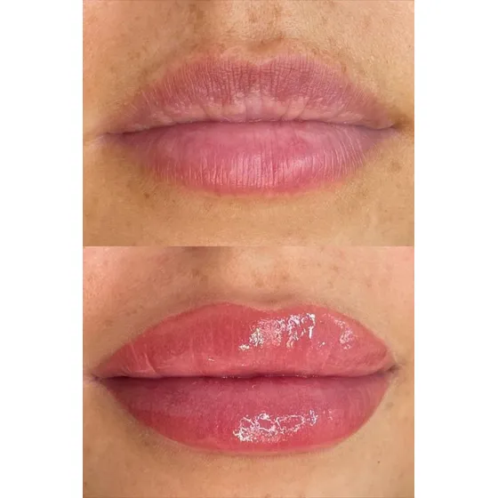 Micropigmentación Labios Efecto Blush, Full O Neutralización