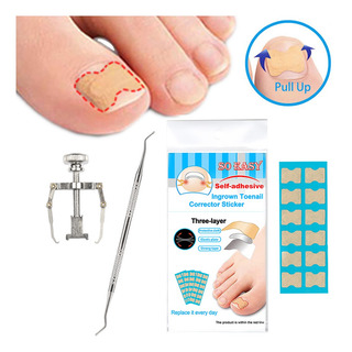 Kit De Correção De Unhas Encravadas Unha Adesivos Dedo Do Pé Kit De Correção De Unhas Encravadas Unha Adesivos Dedo Do Pé